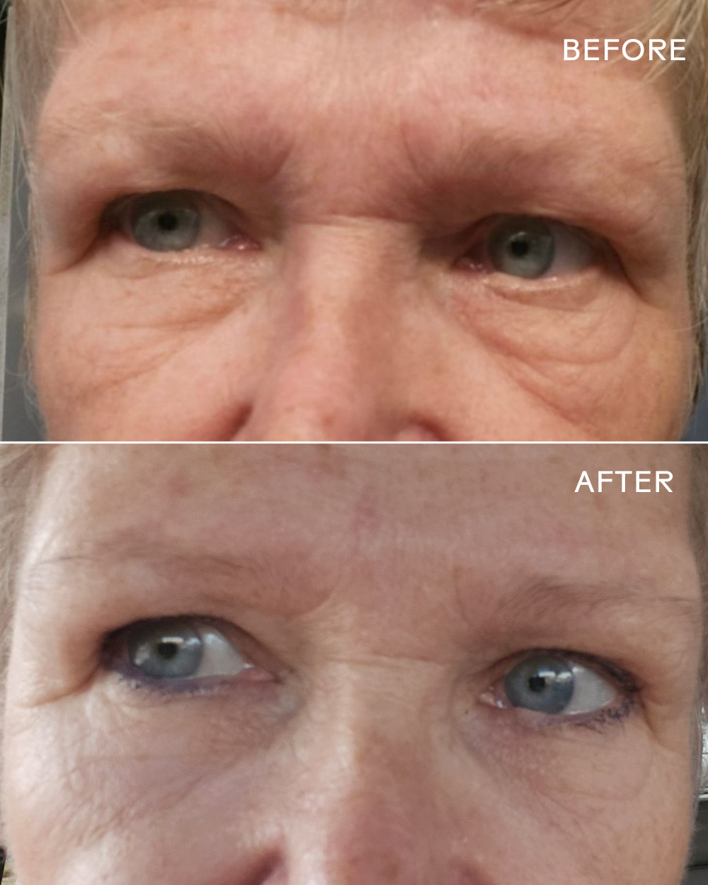 EyeHero™  Bio-Retinol Smoothing Eye Cream