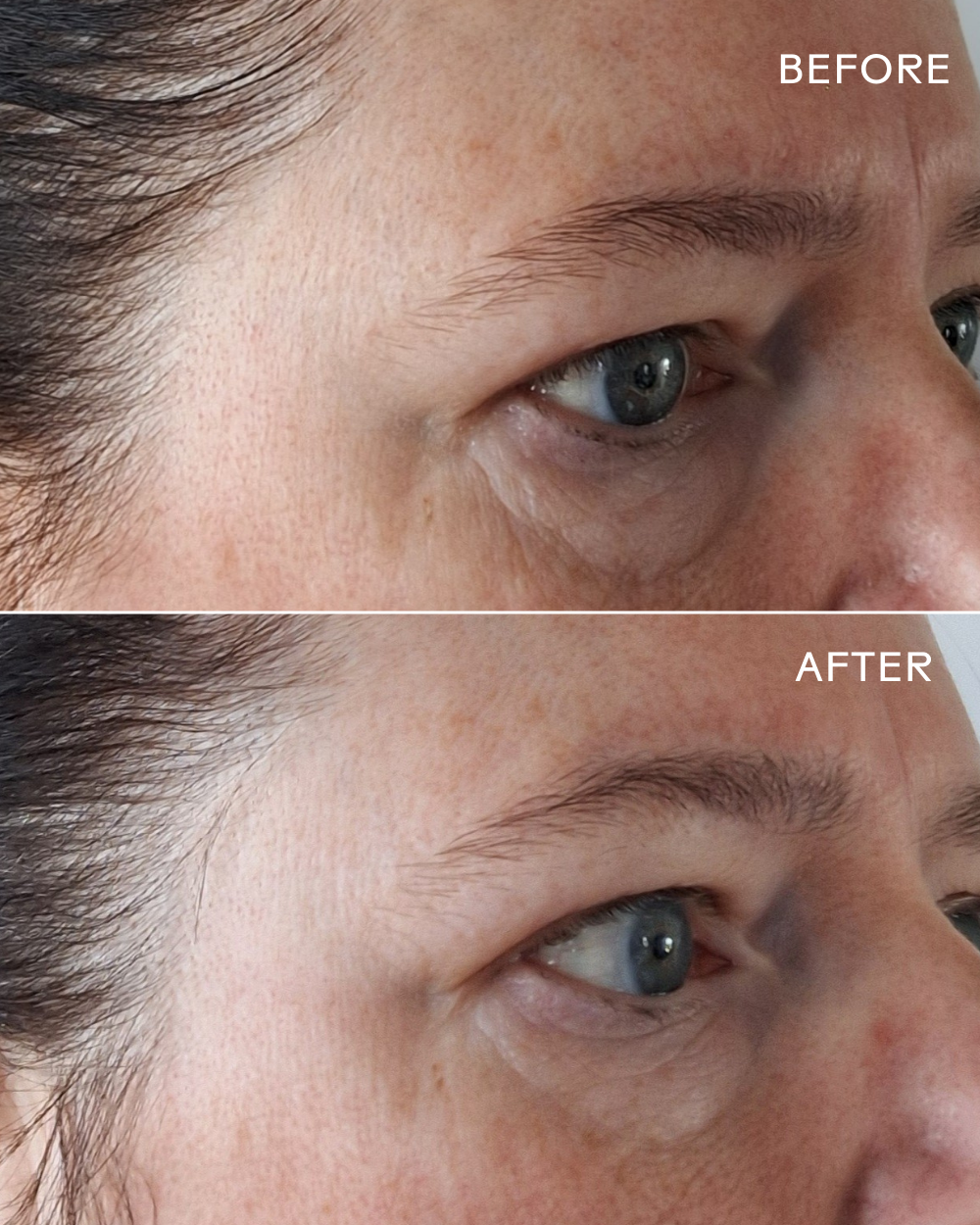 EyeHero™  Bio-Retinol Smoothing Eye Cream